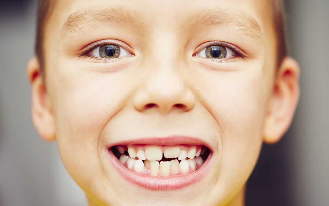 How Bad Teeth Can Affect Your Health